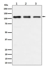 Anti-TAOK1 Rabbit Monoclonal Antibody Boster Bio