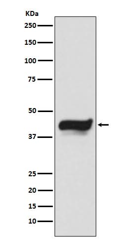 Anti-IKB epsilon NFKBIE Monoclonal Antibody Boster Bio