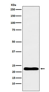 Anti-TNNI1 Rabbit Monoclonal Antibody Boster Bio