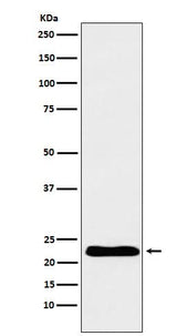 Anti-TNNI1 Rabbit Monoclonal Antibody Boster Bio