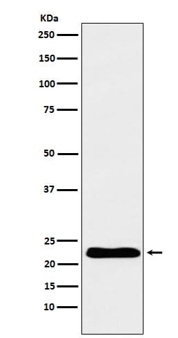 Anti-TNNI1 Rabbit Monoclonal Antibody Boster Bio