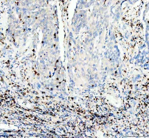 Anti-Integrin alpha E ITGAE Rabbit Monoclonal Antibody Boster Bio