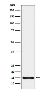 Anti-SAA4 Rabbit Monoclonal Antibody Boster Bio