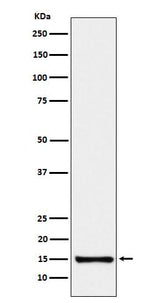 Anti-SAA4 Rabbit Monoclonal Antibody Boster Bio
