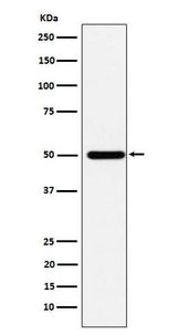 Anti-ABAT Rabbit Monoclonal Antibody Boster Bio