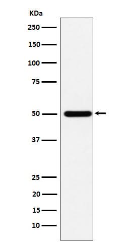 Anti-ABAT Rabbit Monoclonal Antibody Boster Bio