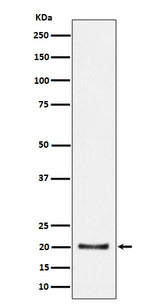 Anti-CSN8 Rabbit Monoclonal Antibody Boster Bio