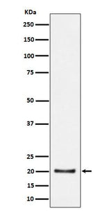 Anti-CSN8 Rabbit Monoclonal Antibody Boster Bio