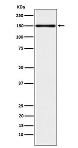 Anti-CLSTN1 Rabbit Monoclonal Antibody Boster Bio