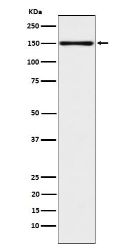 Anti-CLSTN1 Rabbit Monoclonal Antibody Boster Bio