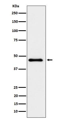 Anti-ELP4 Rabbit Monoclonal Antibody Boster Bio