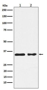 Anti-CSNK1A1 Rabbit Monoclonal Antibody Boster Bio