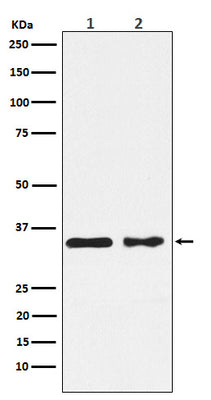 Anti-CSNK1A1 Rabbit Monoclonal Antibody Boster Bio