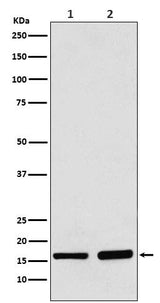Anti-AP2S1 Rabbit Monoclonal Antibody Boster Bio