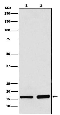 Anti-AP2S1 Rabbit Monoclonal Antibody Boster Bio