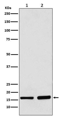 Anti-AP2S1 Rabbit Monoclonal Antibody Boster Bio
