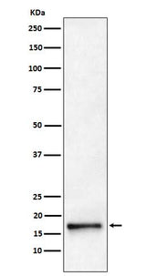 Anti-AP2S1 Rabbit Monoclonal Antibody Boster Bio