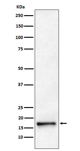 Anti-AP2S1 Rabbit Monoclonal Antibody Boster Bio