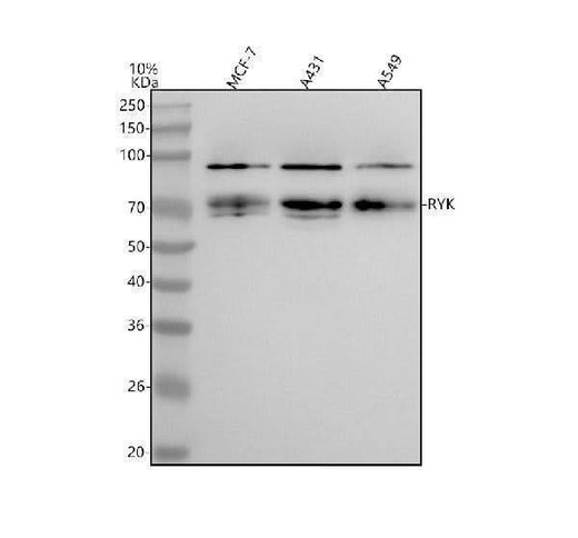 Anti-RYK Rabbit Monoclonal Antibody Boster Bio