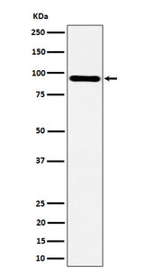 Anti-TNS4 Rabbit Monoclonal Antibody Boster Bio