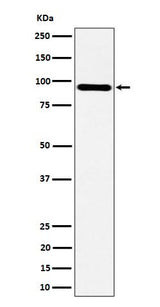 Anti-TNS4 Rabbit Monoclonal Antibody Boster Bio
