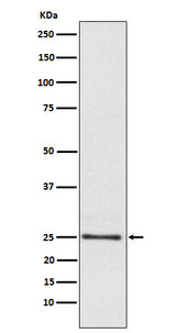 Anti-Lysophospholipase 1 Rabbit Monoclonal Antibody Boster Bio