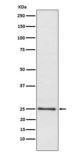 Anti-Lysophospholipase 1 Rabbit Monoclonal Antibody Boster Bio