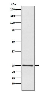 Anti-Lysophospholipase 1 Rabbit Monoclonal Antibody Boster Bio