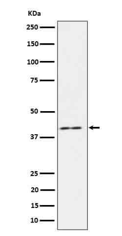 Anti-IL18 binding protein Rabbit Monoclonal Antibody Boster Bio