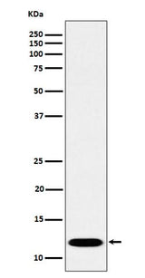 Anti-PCBD1 Rabbit Monoclonal Antibody Boster Bio