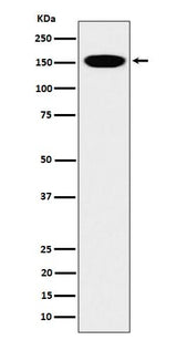 Anti-CNAP1 Rabbit Monoclonal Antibody Boster Bio