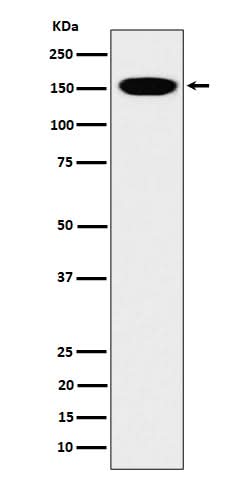 Anti-CNAP1 Rabbit Monoclonal Antibody Boster Bio