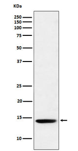 Anti-Histone H2B (formyl K120) Rabbit Monoclonal Antibody Boster Bio