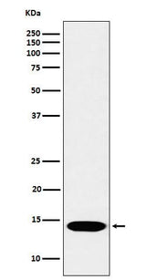 Anti-Histone H2B (mono methyl K116) Rabbit Monoclonal Antibody Boster Bio