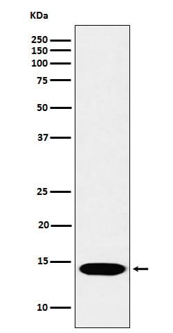 Anti-Histone H2B (mono methyl K116) Rabbit Monoclonal Antibody Boster Bio