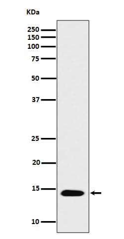 Anti-Histone H2B (acetyl K16) Rabbit Monoclonal Antibody Boster Bio