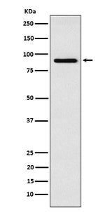 Anti-RSK4 Rabbit Monoclonal Antibody Boster Bio