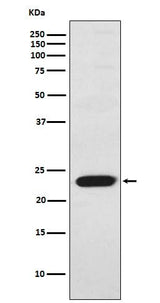Anti-TNNI2 Rabbit Monoclonal Antibody Boster Bio