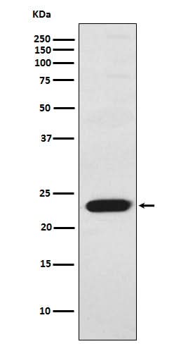 Anti-TNNI2 Rabbit Monoclonal Antibody Boster Bio