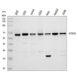 Anti-STK33 Rabbit Monoclonal Antibody Boster Bio