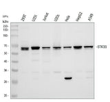Anti-STK33 Rabbit Monoclonal Antibody Boster Bio