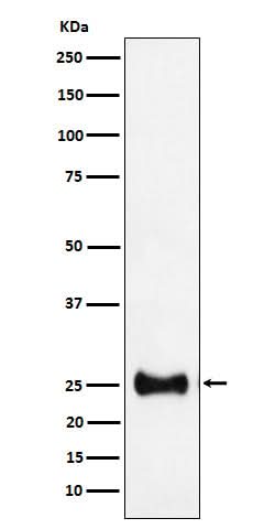 Anti-Adenylate kinase 4 Rabbit Monoclonal Antibody Boster Bio