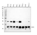 Anti-NOP10 Rabbit Monoclonal Antibody Boster Bio