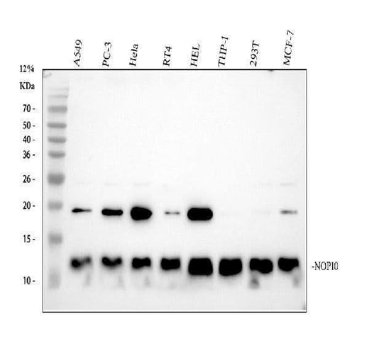 Anti-NOP10 Rabbit Monoclonal Antibody Boster Bio