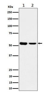 Anti-AAMP Rabbit Monoclonal Antibody Boster Bio