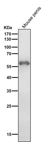 Anti-Cytokeratin 4 KRT4 Rabbit Monoclonal Antibody Boster Bio