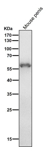 Anti-Cytokeratin 4 KRT4 Rabbit Monoclonal Antibody Boster Bio