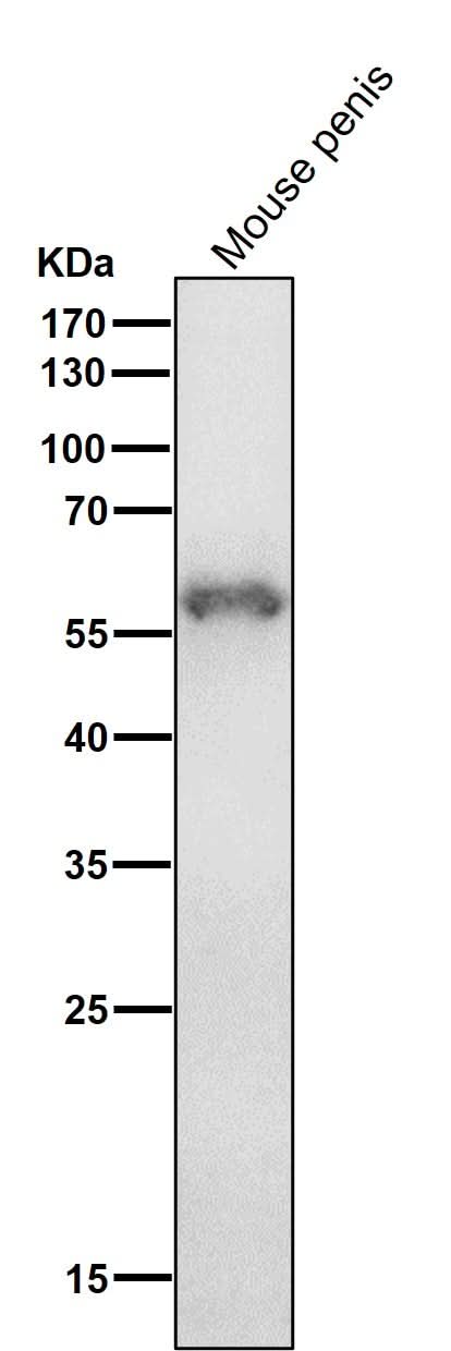 Anti-Cytokeratin 4 KRT4 Rabbit Monoclonal Antibody Boster Bio