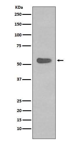 Anti-Cytokeratin 4 KRT4 Rabbit Monoclonal Antibody Boster Bio