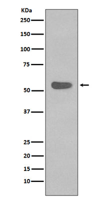 Anti-Cytokeratin 4 KRT4 Rabbit Monoclonal Antibody Boster Bio